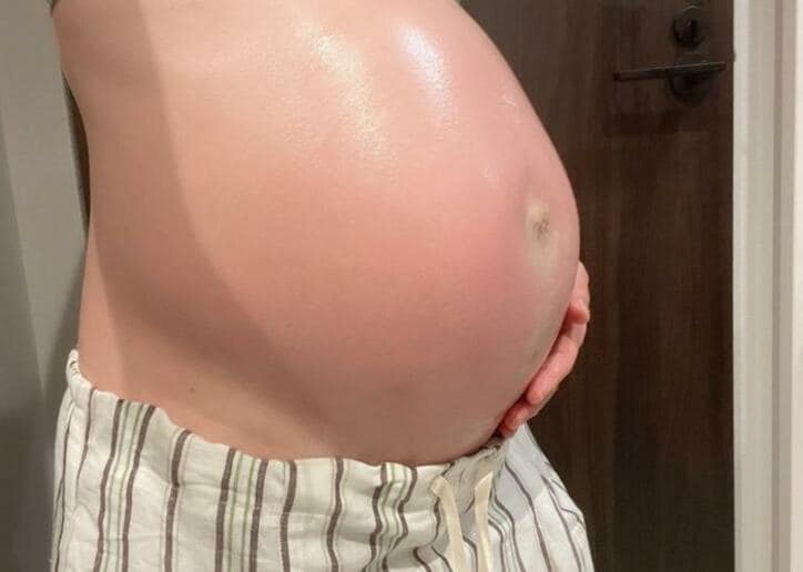  あいのり・桃、1人目の妊娠時と現在のお腹の比較写真を公開「おへそのサイズが3倍」 