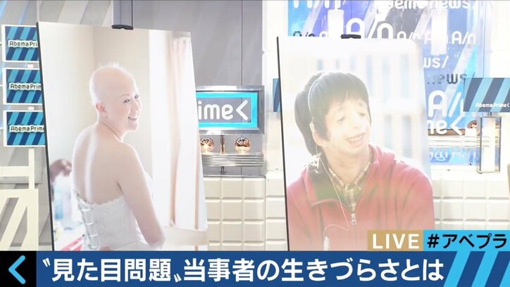 実は100万人が抱える“見た目問題” 当事者たちの生きづらさとは
