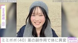 34歳で約2カ月の余命宣告・ミミポポ（40）、抗がん剤の副作用で体に異変「手先のしびれ」「足が上がらない」