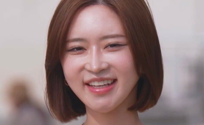 【写真・画像】「子供に“ママと自分は顔が違う”って言われたらどうする？」23歳整形美女、29歳無整形イケメンからの質問に本音で回答　1枚目