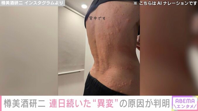 「体が悲鳴を…」樽美酒研二（44）、連日続いた“異変” まさかの原因が判明「全く気にもしてませんでした」 3枚目