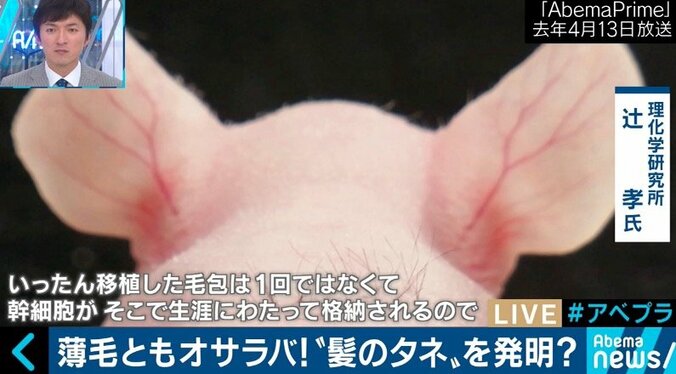 2020年には薄毛治療に革新？日本の再生医療技術がついに“髪のタネ”を発明 1枚目