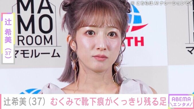 【写真・画像】第5子妊娠中・辻希美「ずっと靴下はいてるのもキツい」むくみで悩む足の写真を公開　1枚目