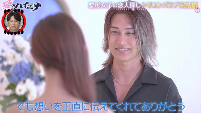 【写真・画像】 「整形総額約1000万円」レスが原因で豊胸した28歳美女「誰かのためにする整形はもうしたくない」26歳無整形イケメンに告白　2枚目