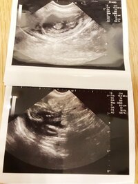 杉浦太陽＆辻希美、愛犬に新しい命が授かったことを報告「杉浦家に新しい命が…」