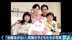 “1年以上の生存率は10％”…18トリソミー児の家族たちが写真展に託した苦悩と葛藤