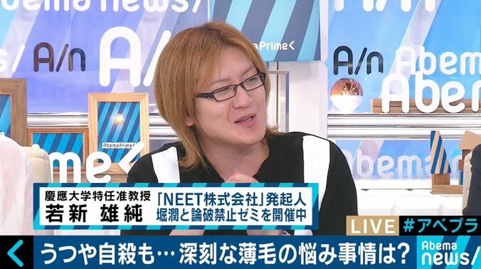 2020年には薄毛治療に革新？日本の再生医療技術がついに“髪のタネ”を発明 9枚目