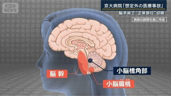 手術した部分