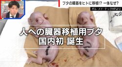 【独自】動物の臓器をヒトに移植、遺伝子改変で拒絶反応回避 “ブタ”が選ばれる理由を医師が解説「大きさも解剖学的な構造も非常によく似ている」