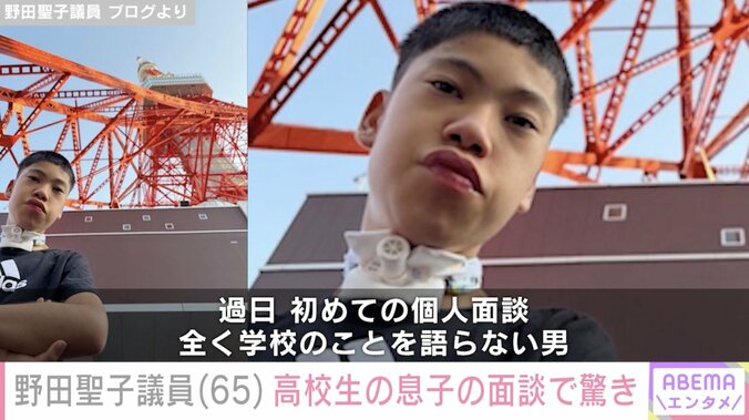 【写真・画像】50歳で出産 野田聖子議員（65）、生後2年以上入院した高校生息子の初面談で驚き「あり得ないことばかり」　2枚目