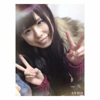 有村藍里、ガミースマイル克服のため歯茎をカット「どんどん笑いたいなあと思います！」