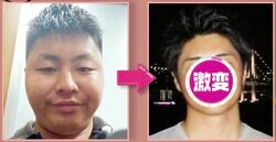 体重103kg→68kgまで減量した男性、ビフォーアフターに衝撃 SNSでは「コン・ユに似ている」と話題に