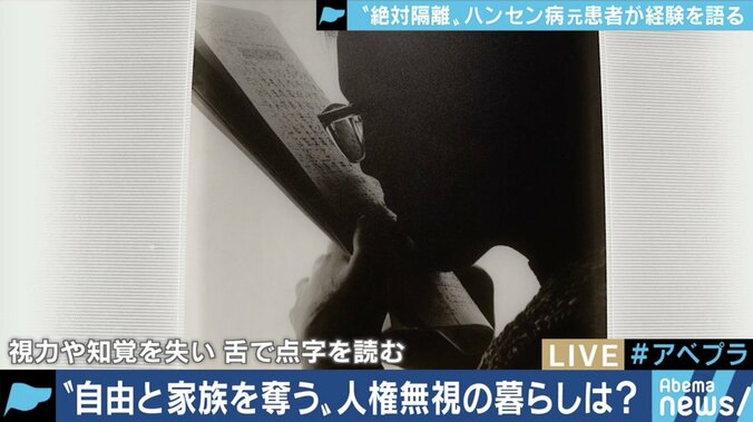 「二度と学校に来るな」と教師に言われた小６の夏から70年…差別や偏見と闘い続けてきたハンセン病回復者の半生 2枚目