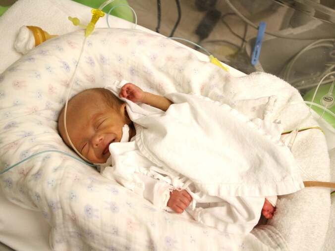 写真家の田尾沙織さん、500gで生まれ生後0か月で肝臓が悪かった息子「顔色悪いな…」  1枚目