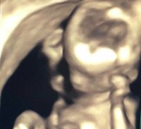 川島菜月『男の子？女の子？』