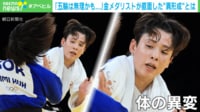 【映像】金メダリストが直面した“異形成”とは