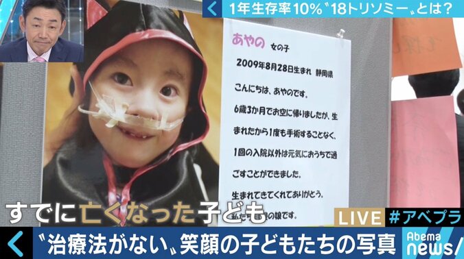 “1年以上の生存率は10％”…18トリソミー児の家族たちが写真展に託した苦悩と葛藤 11枚目