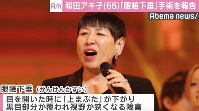 和田アキ子、“眼瞼下垂”手術を報告「心と体は元気いっぱい」 2枚目