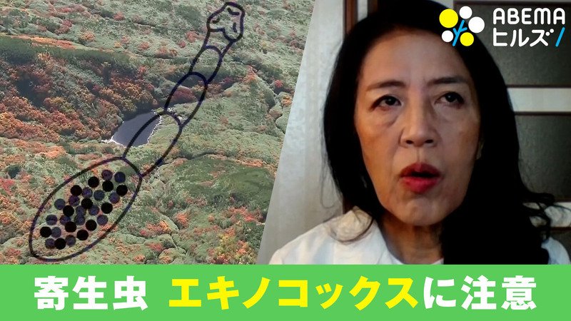 ABEMAヒルズ【平日ひる12時〜生放送】 - 最新NEWS - 忍びよる寄生虫 エキノコックス症とは (ニュース) | 無料動画・見逃し配信を見るなら | ABEMA