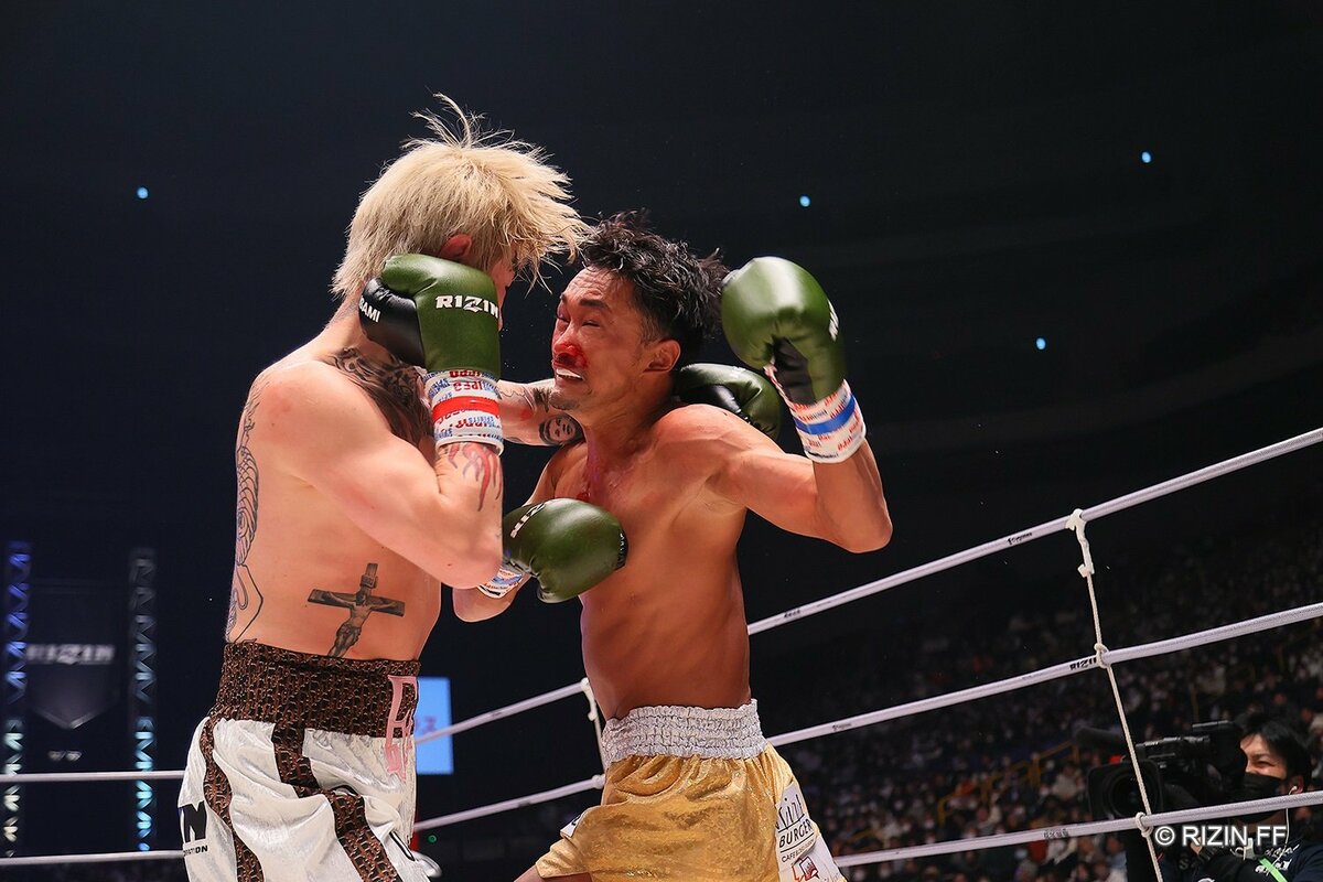 大晦日に“事実上KO”の平本蓮、2023年はベルト獲りへ 朝倉未来戦は