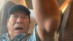  ダンカン、肘に出来た黒いアザについて医師に聞いた結果「ボコっと膨らんでました」 