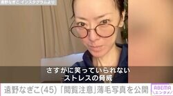 摂食障害公表の遠野なぎこ(45) 「閲覧注意」薄毛写真を公開しファンから心配の声「病院レベルです」「お大事にしてご自愛くださいね」