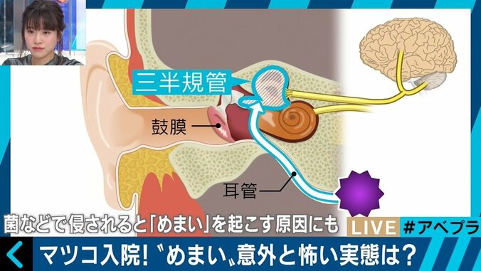 マツコも入院！重篤な疾患の前兆の可能性もある「めまい」 2枚目