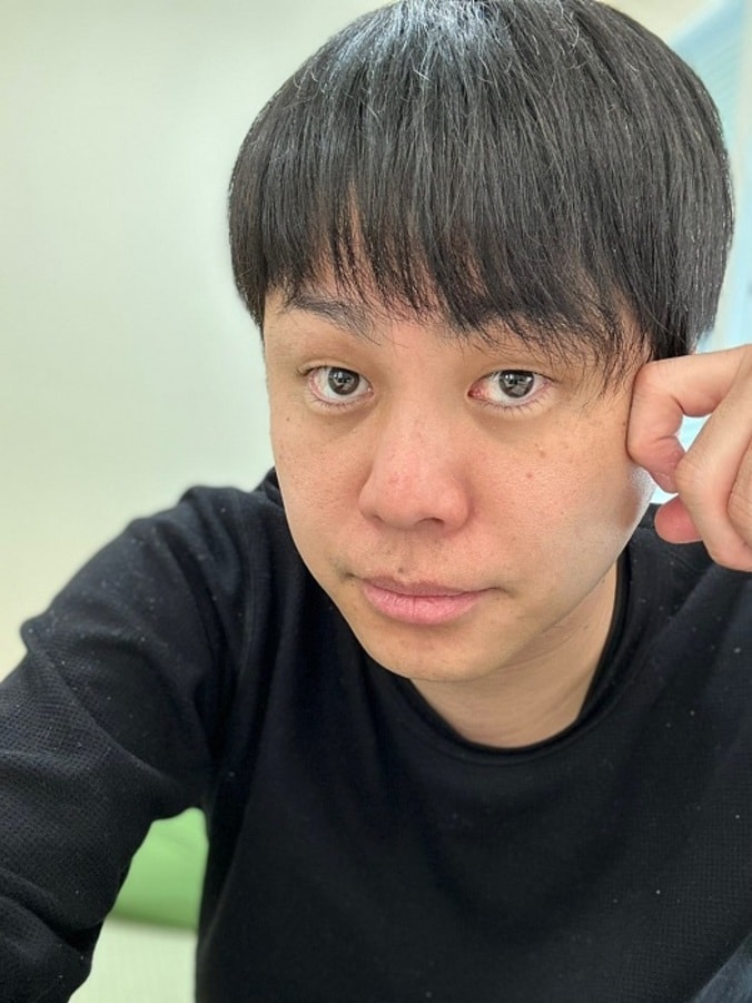  ノンスタ井上、人間ドックで医師から指摘されたこと「命に別状がある事ではないけど」  1枚目