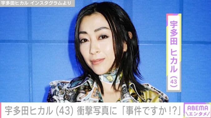 宇多田ヒカル