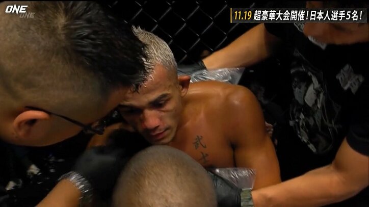 「足がゾウのようにパンパンに…」視聴者どよめき 予想外の結末に「腫れすぎ」「折れてる」心配の声