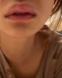 光上せあら『発熱.コロナっぽいが、、どうかな。』