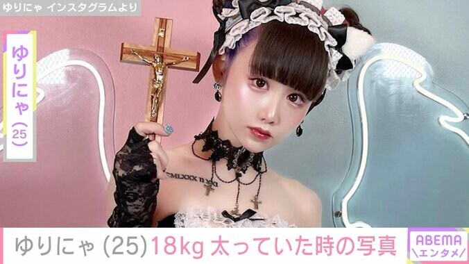 【写真・画像】減量ビフォアフが話題・ゆりにゃ、今よりも18kg太っていた頃の写真公開「注射ごときでゆりかの体形には絶対なれないよ〜ん」　1枚目