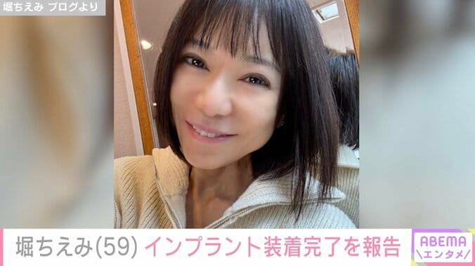 【写真・画像】“施術後の姿”を披露した堀ちえみ、インプラント装着完了を報告「頑張ったね 歯は命だもんね」などの声　1枚目