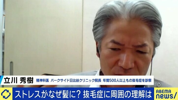 中学受験のストレスで発症してしまう小学生も…「気付いたら周りが頭髪だらけに…」やめたいのにやめられない“抜毛症”に悩み続ける女性