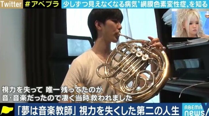 少しずつ奪われる視力、視野…“見えることが前提の社会”で悩む5万人の網膜色素変性症患者たち