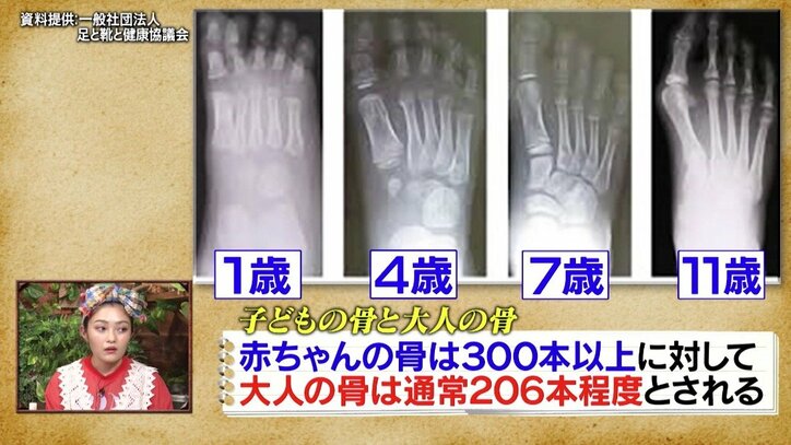 人間は大人に成長するにつれて「骨の数が減っていく」? その理由とは
