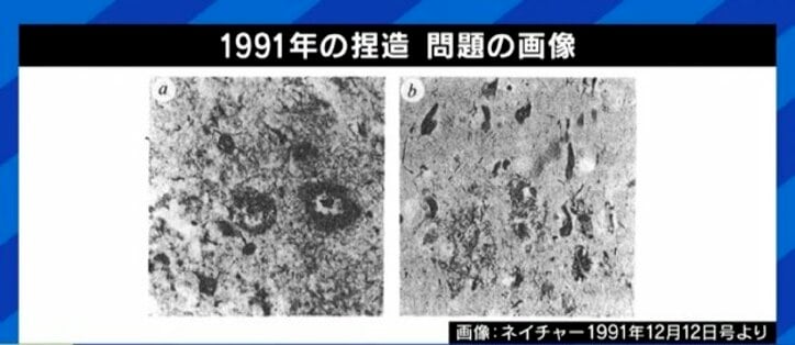 16年前の論文に捏造疑惑…世界の研究者の長年の努力は無駄に?今後の研究や創薬への影響は?『アルツハイマー征服』著者に聞く
