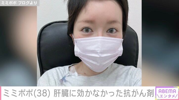 【写真・画像】34歳で余命宣告を受けたミミポポ（38）、抗がん剤が肝臓に効かなかったことを明かす「3カ所ほどの肝臓のがんが…」　1枚目