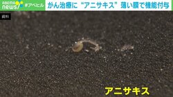 アニサキスが“がん治療”に？ 体内での強い武器になる可能性 研究者「それを飲む日が来るかも」