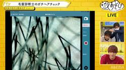 プロの本格診断で浪川大輔＆石川界人の“毛髪事情”が丸裸に…!? 浪川の“頭皮”初公開で「ねぇ恥ずかしい～！」と赤面