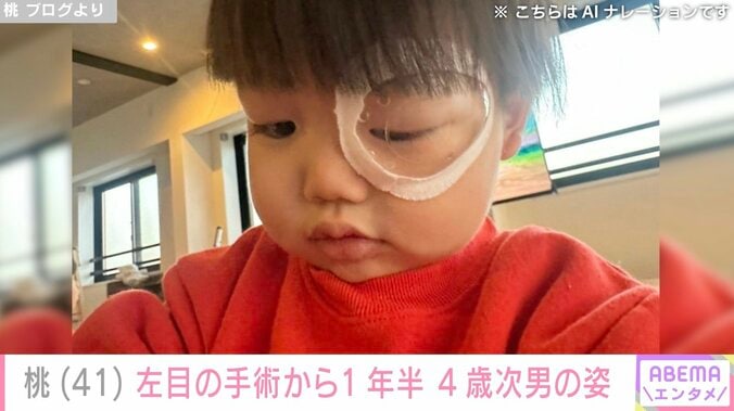 桃（41）、左目の先天性眼瞼下垂症の手術から1年半が経過した4歳次男の姿を公開 5枚目