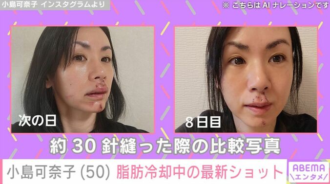 小島可奈子