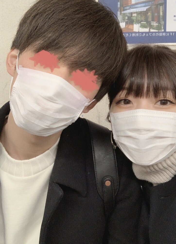 あいのり桃、彼氏のしみ取りレーザー治療後の様子を公開「浮き上がってる感」