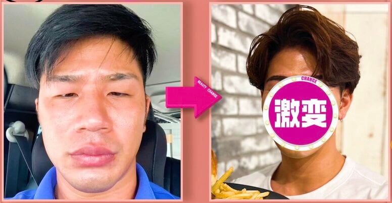 整形費用300万円で岩田剛典に！衝撃ビフォーアフターに絶賛の声「かっこいい！」「整形した人の顔じゃない」